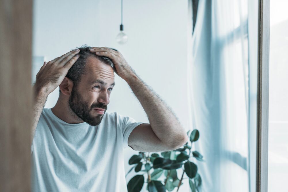 do cigarettes cause hair loss Does cigarette smoking loss? Does Smoking Cause Hair Loss?